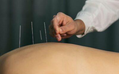 Acupuntura y fisioterapia para tu recuperación